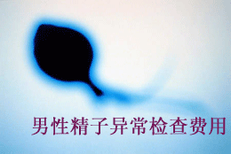 男性精子异常检查费用